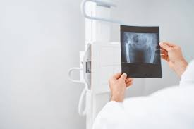 Meningkatkan Kompetensi Melalui Tryout Online Simulasi Radiografer